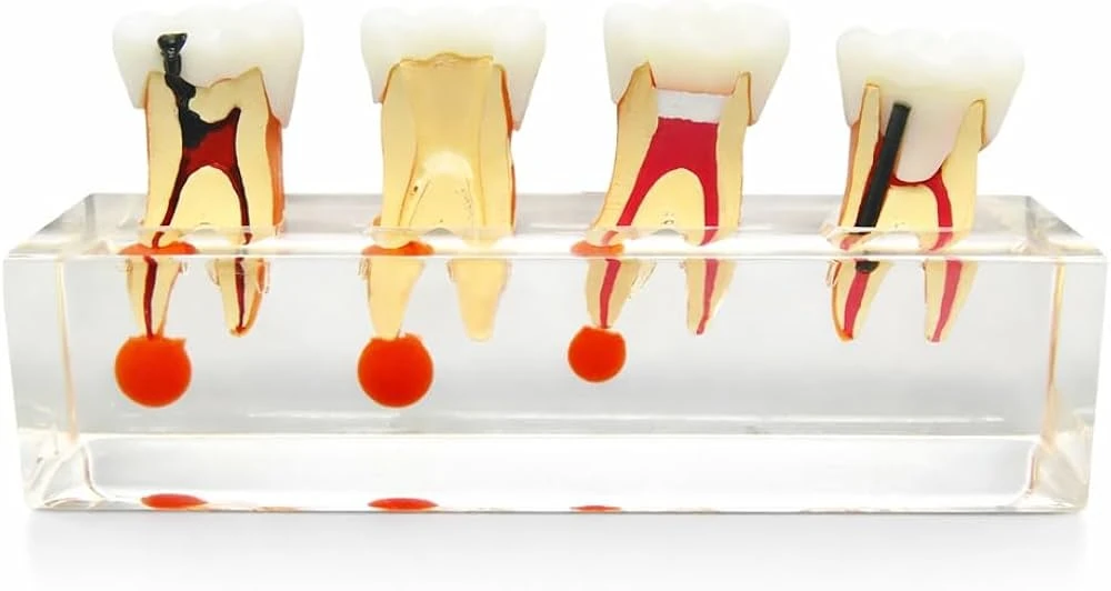 iDENTical Study Model Root Canal Treatment M 4018