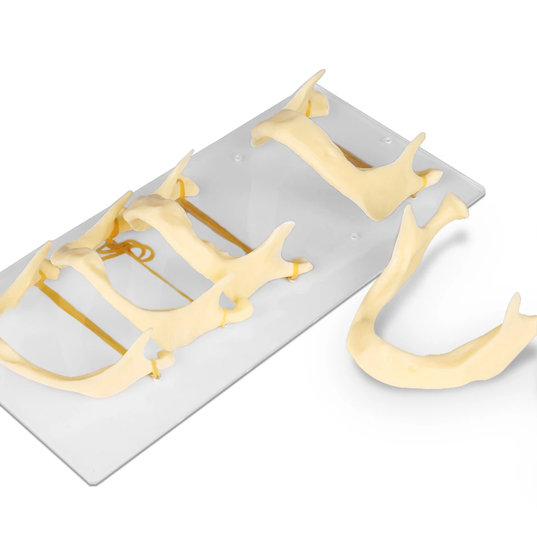 iDENTical The Development of Upper & Lower Jaw Models