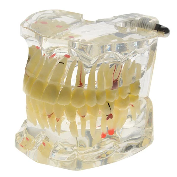 iDENTical Adult Pathologies Model M4001-1